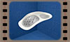 Click to view animation